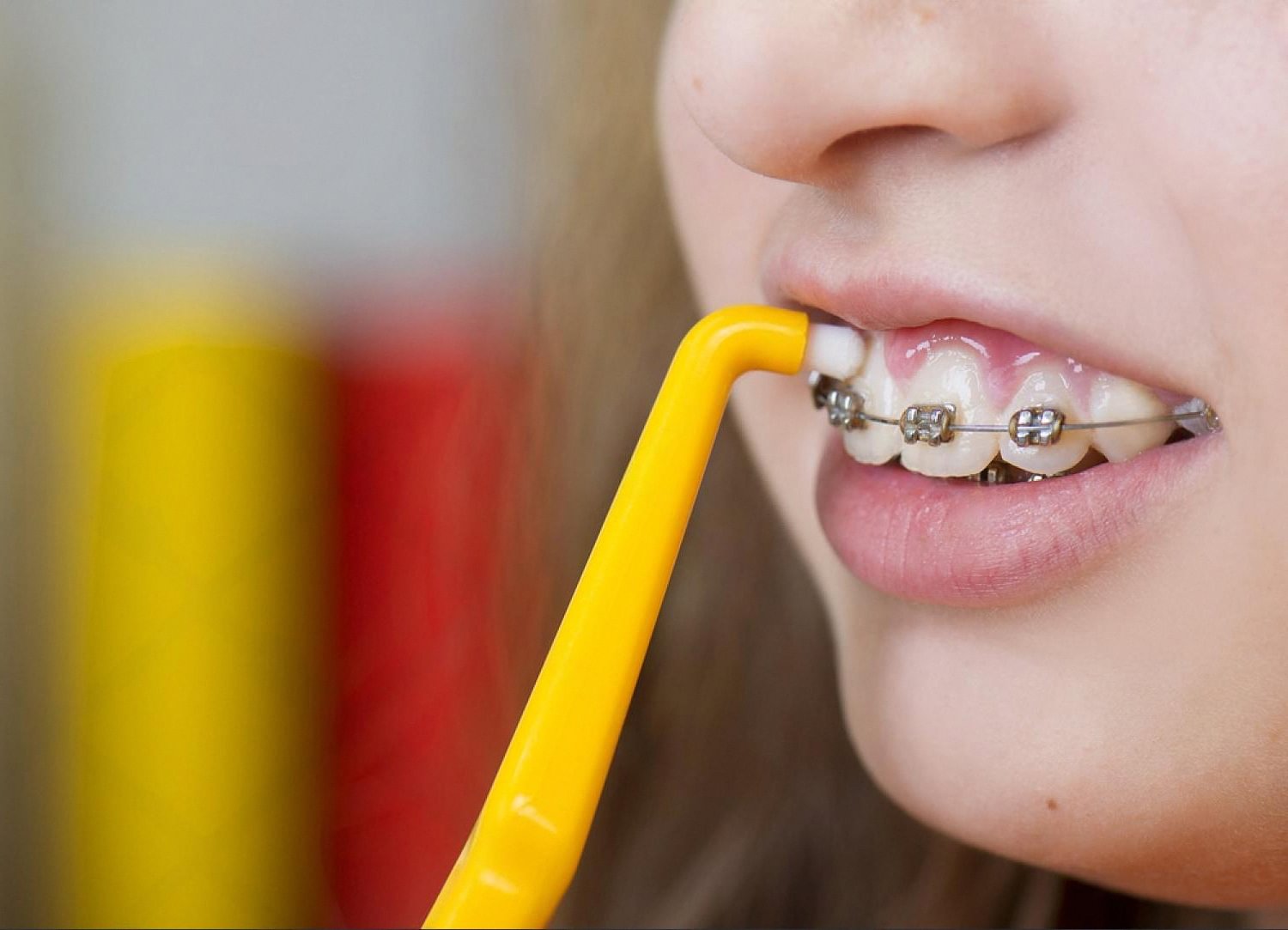 Close-up of a young patient using a yellow interdental brush to clean around metal braces