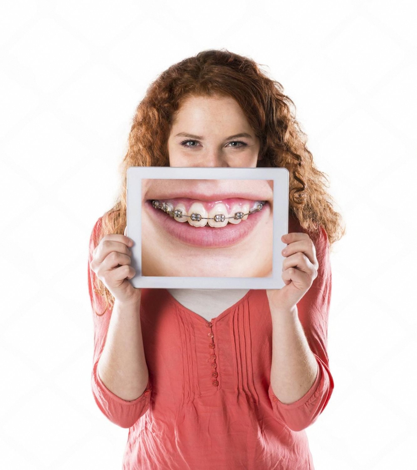 How to Care for Your Teeth While Wearing Braces in the UAE